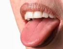 What does the color and shape of the tongue say: diagnostic measures