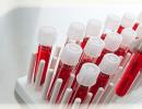 Ako a kedy urobiť krvný test na skríning